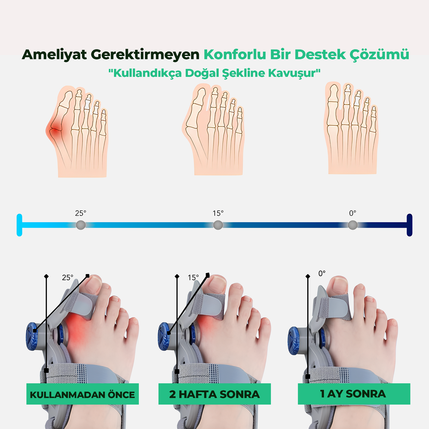 Relaxzone Ayarlı Ayak Baş Parmak Kemik Düzeltici