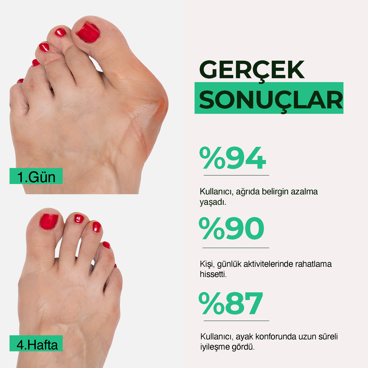 Relaxzone Ayarlı Ayak Baş Parmak Kemik Düzeltici