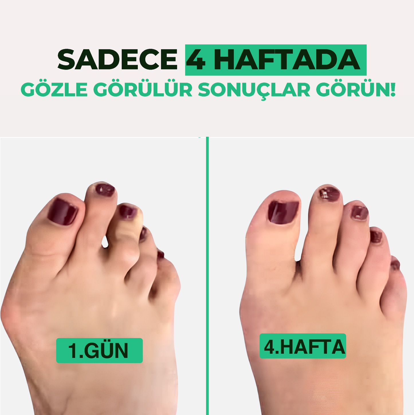 Relaxzone Ayarlı Ayak Baş Parmak Kemik Düzeltici