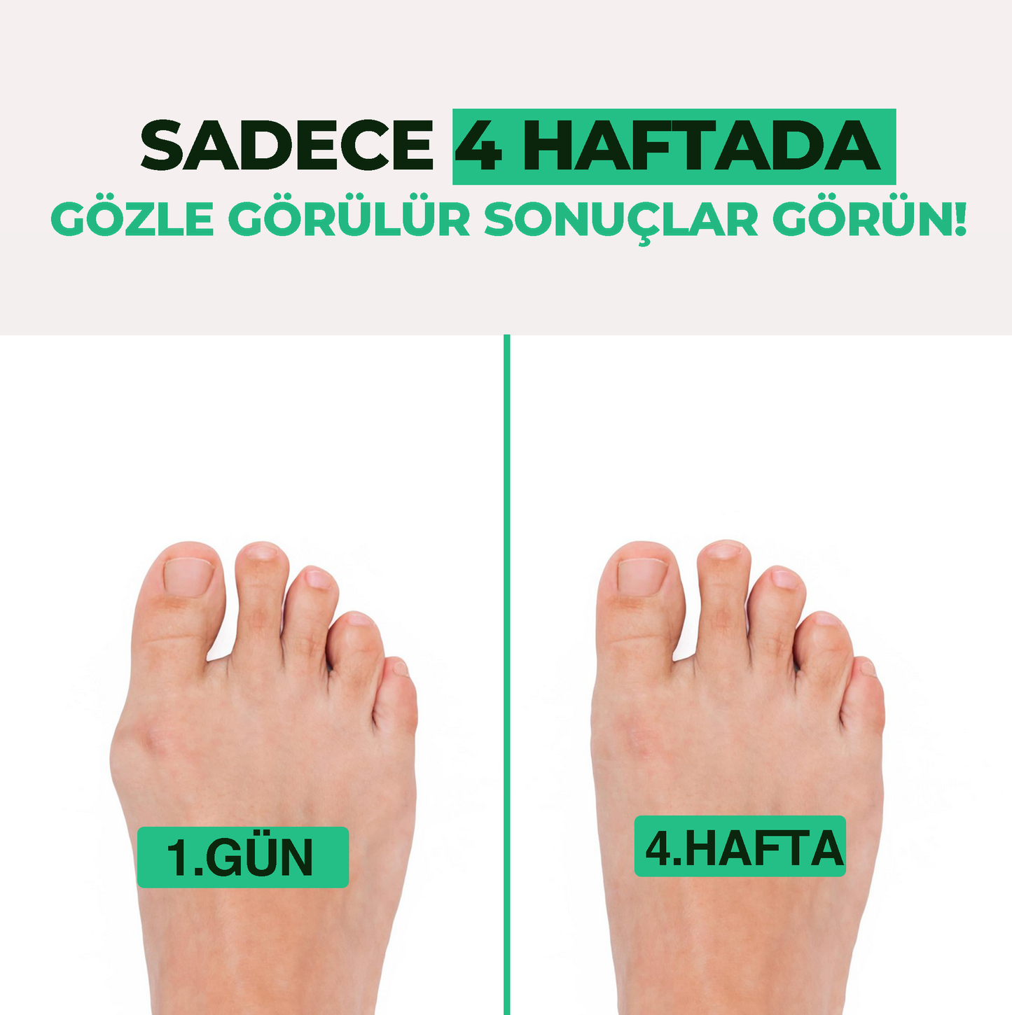 Relaxzone Ayarlı Ayak Baş Parmak Kemik Düzeltici