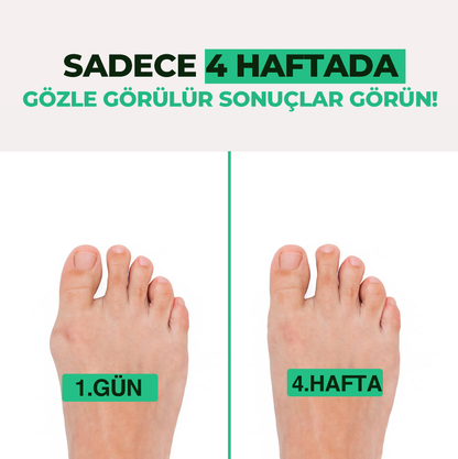 Relaxzone Ayarlı Ayak Baş Parmak Kemik Düzeltici